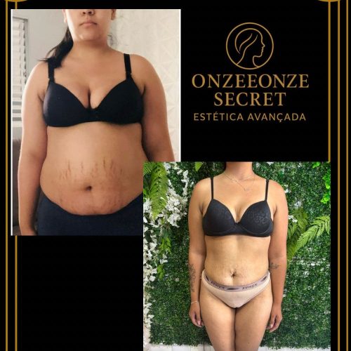 emagrecimento grande (1)